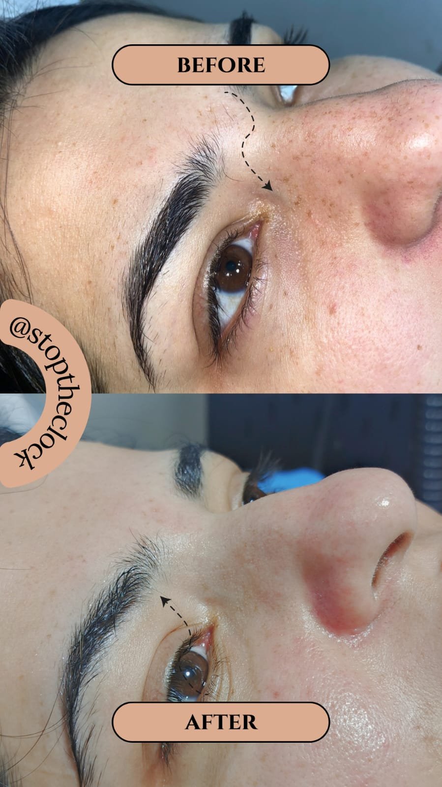 Before and after skin transformation