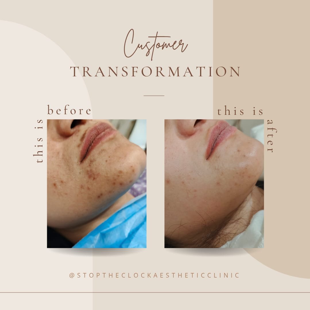 Before and after customer transformation